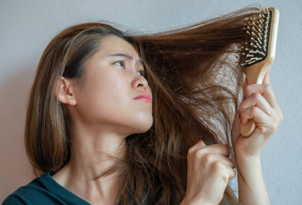 Hair Care Tips : न झड़ेंगे, न आएगा गंजापन, इस तरीके से रखें बालों का ध्यान, हमेशा बने रहेंगे घने और लंबे