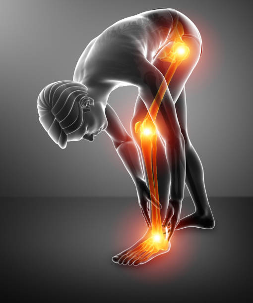 3d Illustration of Pain in leg