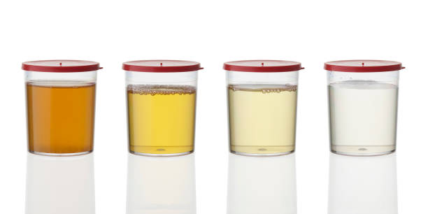 Different urine test samples