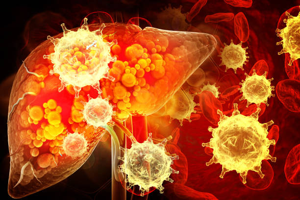 These 4 symptoms seen in the body indicate liver cancer