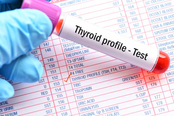 How to spot the warning signs of thyroid Issues