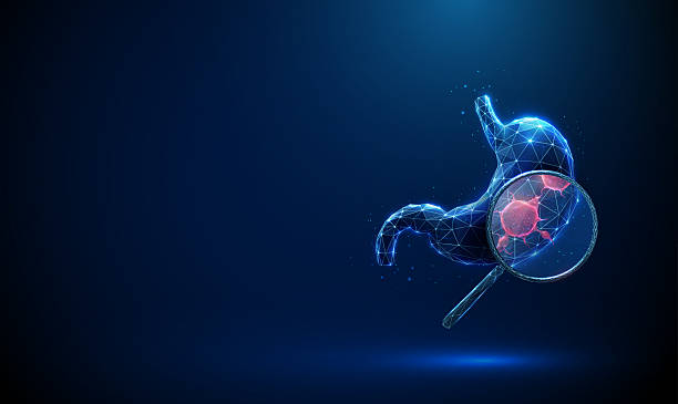 5 Fast Growing Stomach Cancers You Shouldn’t Ignore